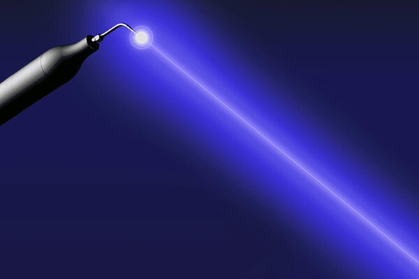 歯周病を切らずに治す！最新の治療法「ブルーラジカル」とは？サムネイル