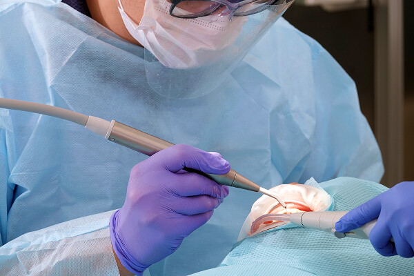 歯周病が治らない方へ、大切な歯を守るための4つの専門治療サムネイル