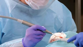 歯周病が治らない方へ、大切な歯を守るための4つの専門治療サムネイル